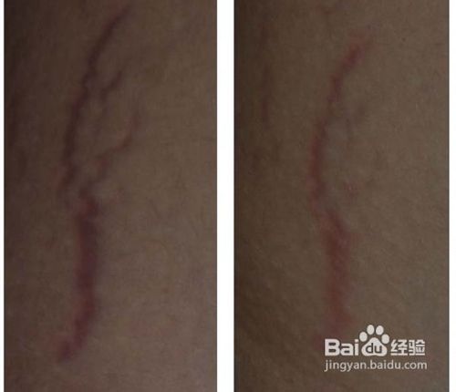 kycom_德甲土豪升班马凶猛！我怕莱比锡 我要抱着你(图2)